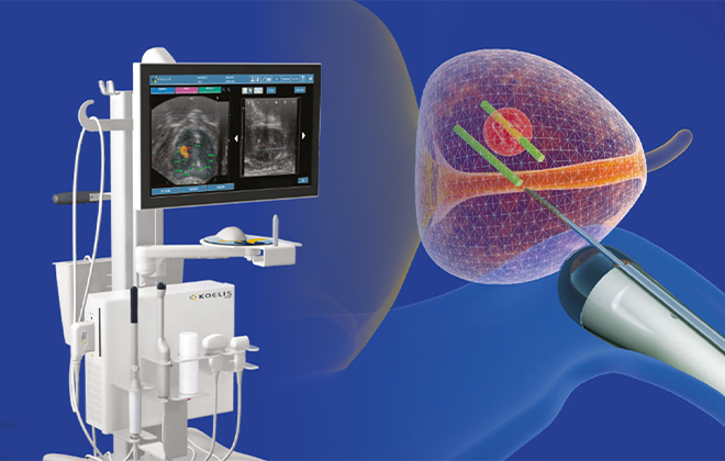 MRI-초음파 융합 표적 조직검사