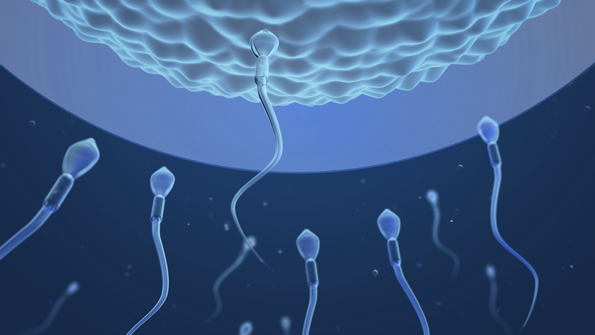 정관복원수술 회복 이미지, 정관수술 후 복원 시기와 임신 가능성 회복을 표현한 정자 이동 및 남성난임 치료 의료 이미지