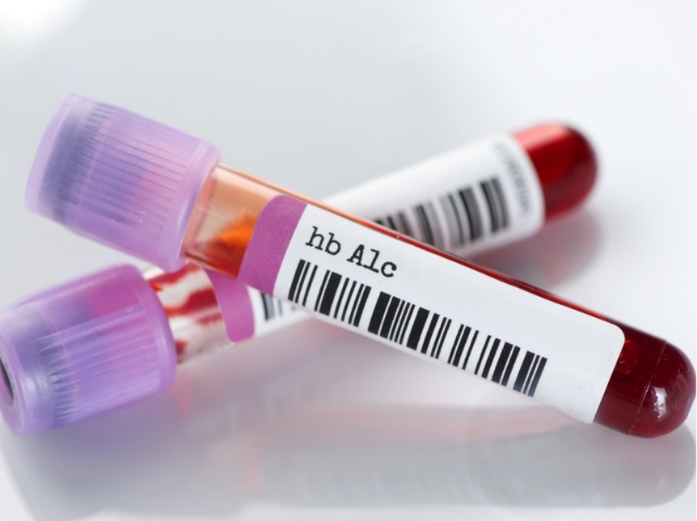 혈액 검사 이미지, 발기부전 검진을 위한 혈당·갑상선호르몬·HbA1c 포함 정밀 혈액검사