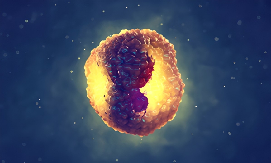 곤지름 이미지, HPV 인유두종바이러스 감염으로 생식기 피부에 사마귀가 발생한 성매개성 질환 이미지